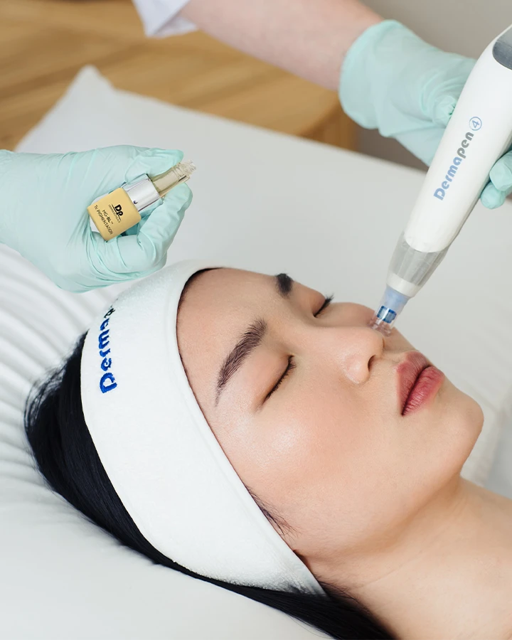 Dermapen microneedling treatment at Corning Wellness for skin rejuvenation